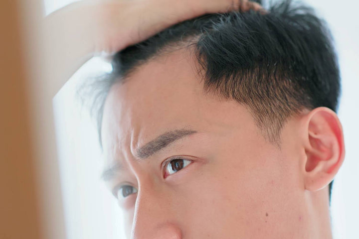 Hair Loss on One Side of the Head: Causes and Evaluation