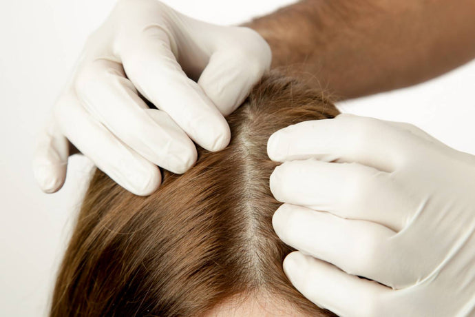 Scalp Health: Why is it Important for Hair Growth?