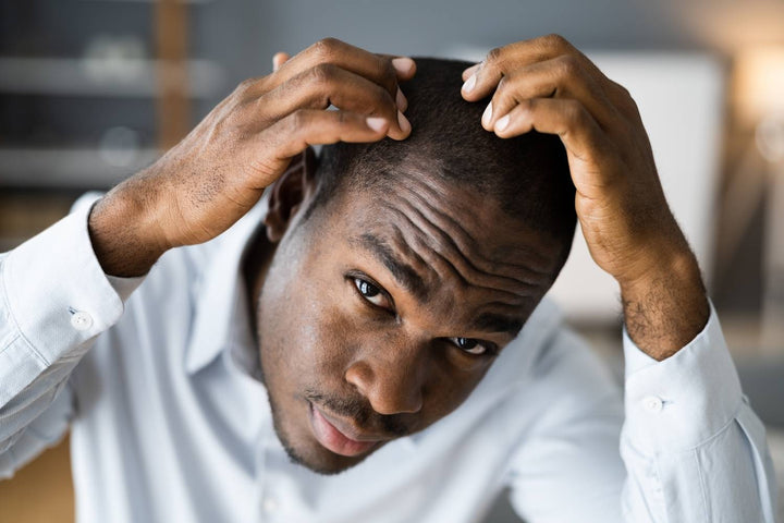 Hair Loss in Men: Common Causes and What to Do