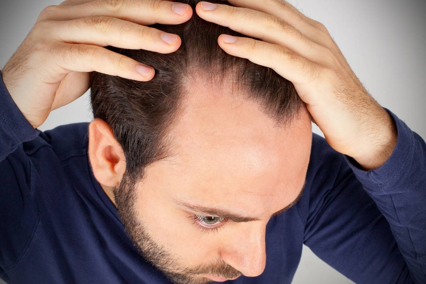 an uneven hairline used with realistic hair-care expectations