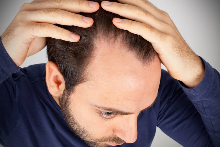 an uneven hairline used with realistic hair-care expectations